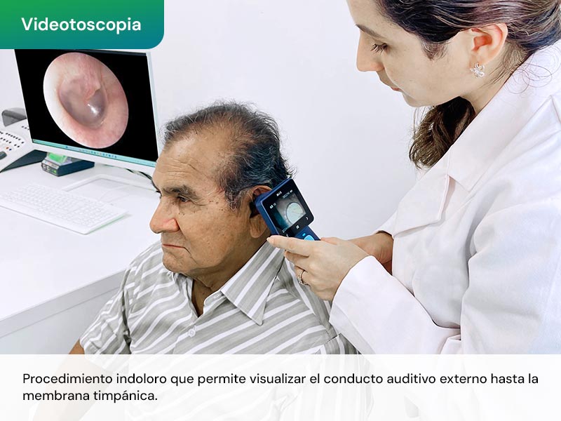 videotoscopia-centro-auditivo-del-norte